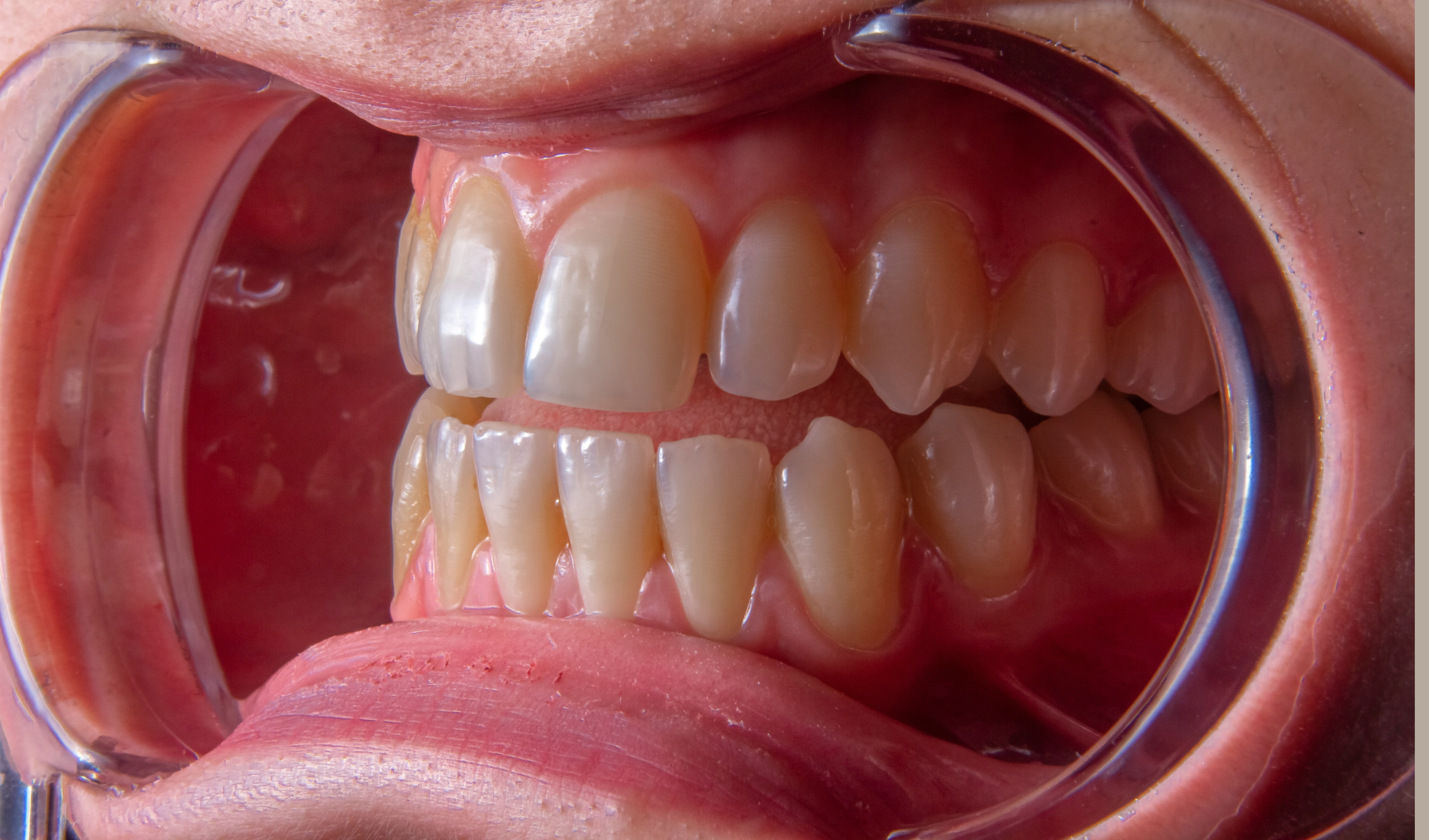 Periodoncia: encías sanas, sonrisa saludable